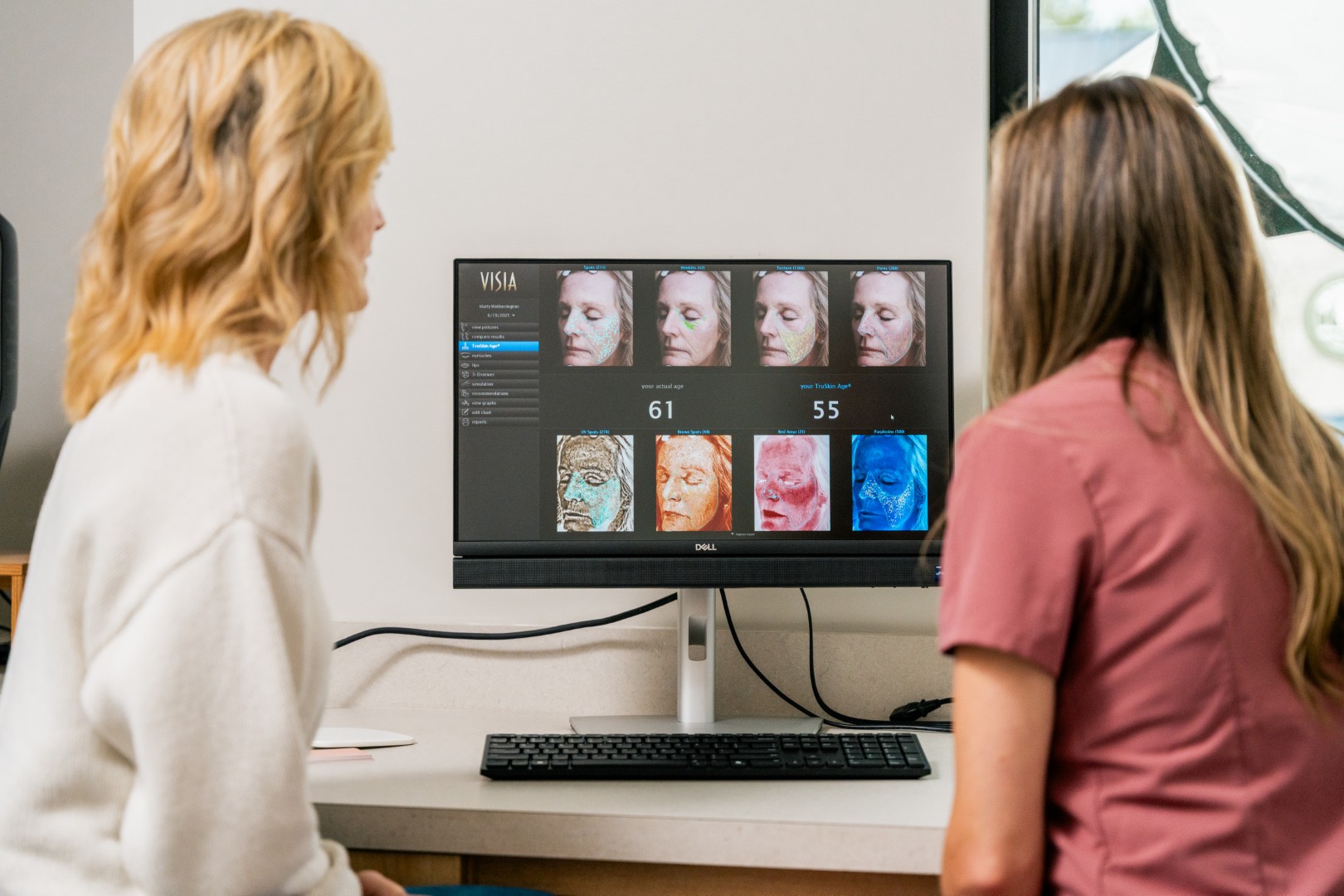 Visia Skin Analysis results on screen